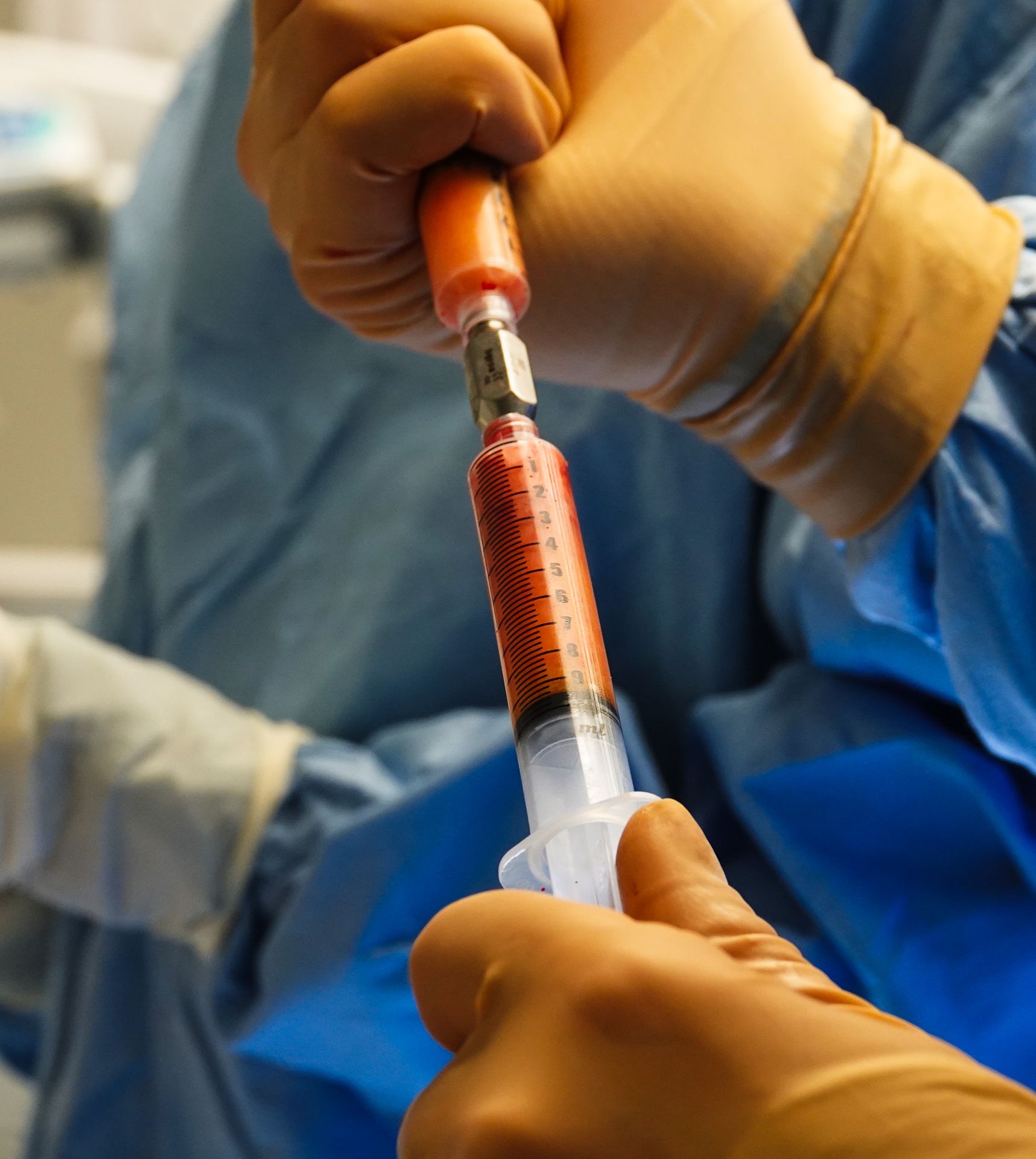 borstvergroting lipofilling